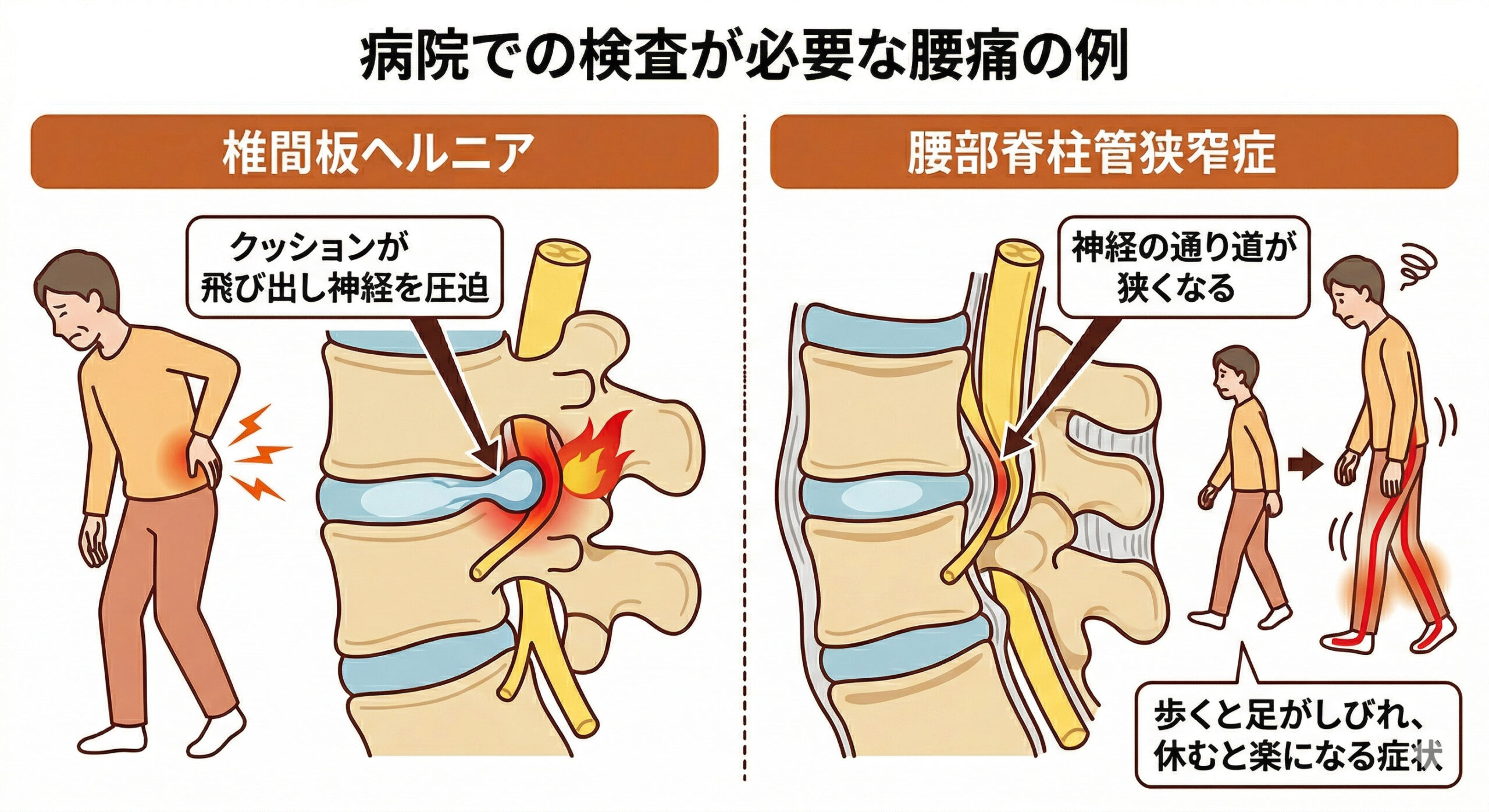 危険な腰痛の例